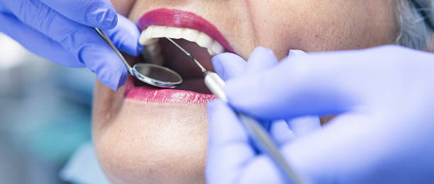 Best Emergency Root Canal Treatment in Hilbert, WI